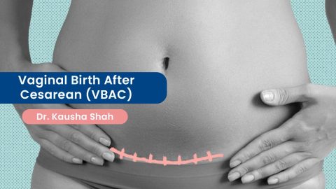 Vaginal Birth After Cesarean (VBAC): A Consideration for Safe Delivery Vaginal Birth After Cesarean (VBAC): A Consideration for Safe Delivery
